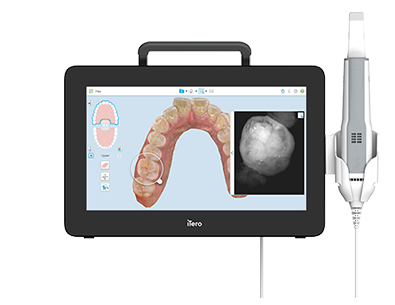iTero Element 5D Plus Lite