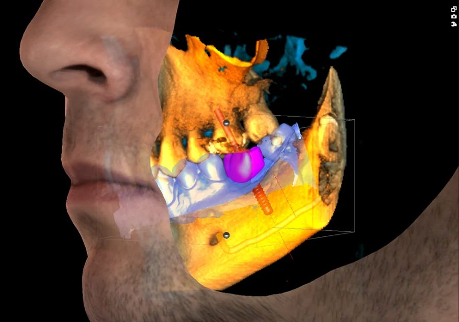 Planmeca ProMax 3D Classic