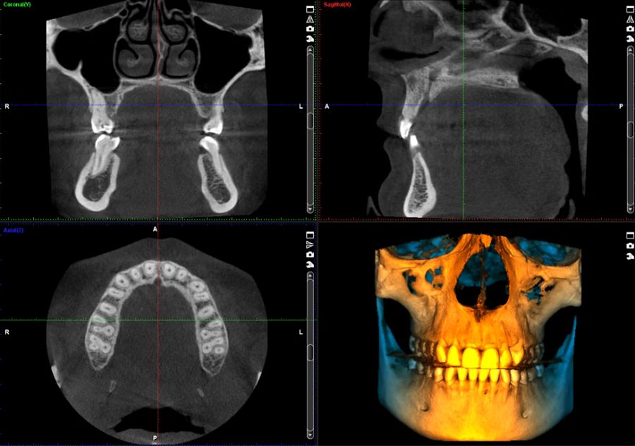 Planmeca ProMax 3D Plus