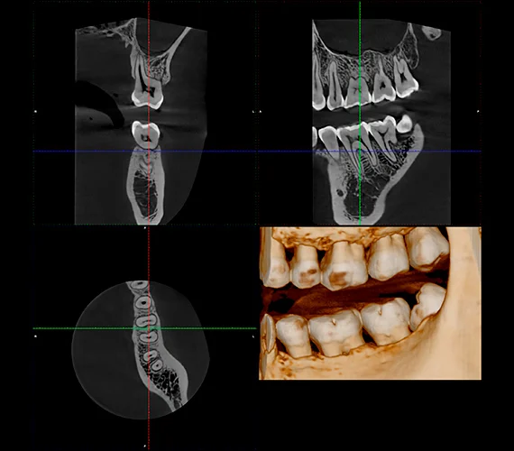 planmeca-viso-g1-endo